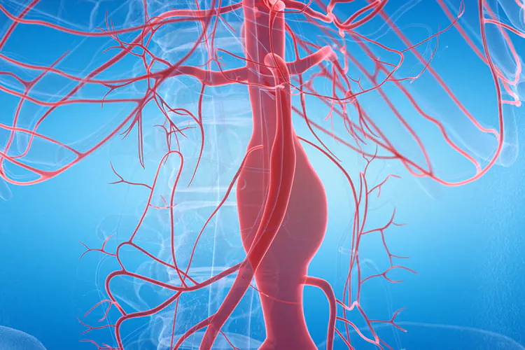 aortic-aneurysm-causes-symptoms-risks